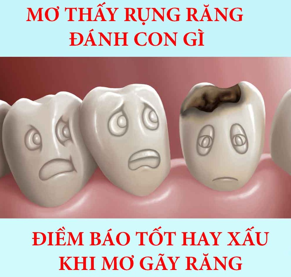 mơ rụng răng